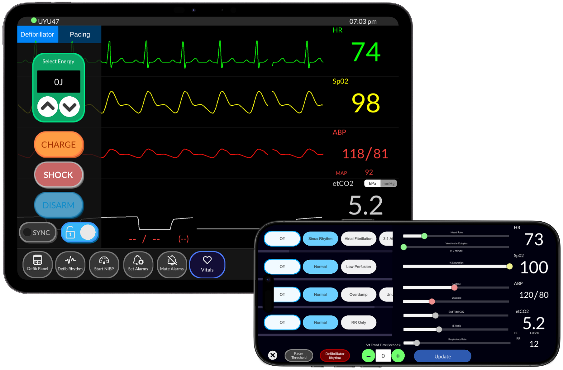 Mockup of the simulator screen